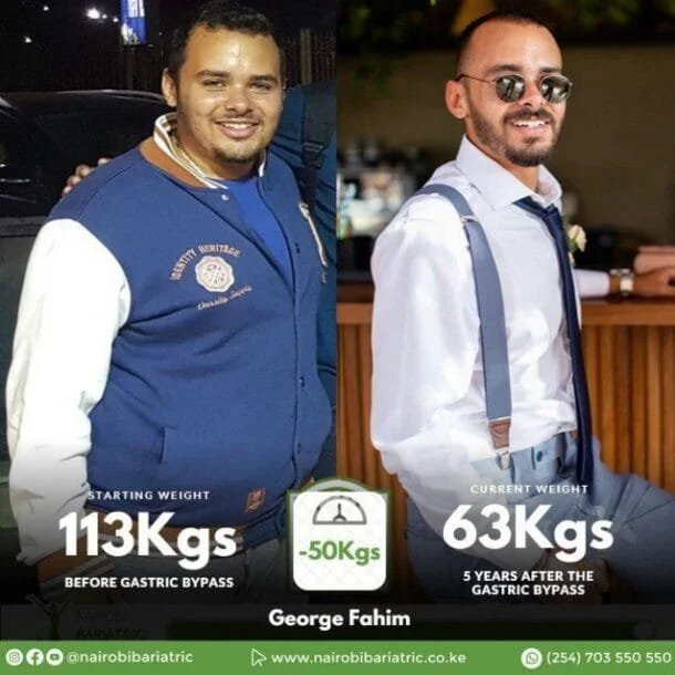 George Fahim — Gastric Sleeve