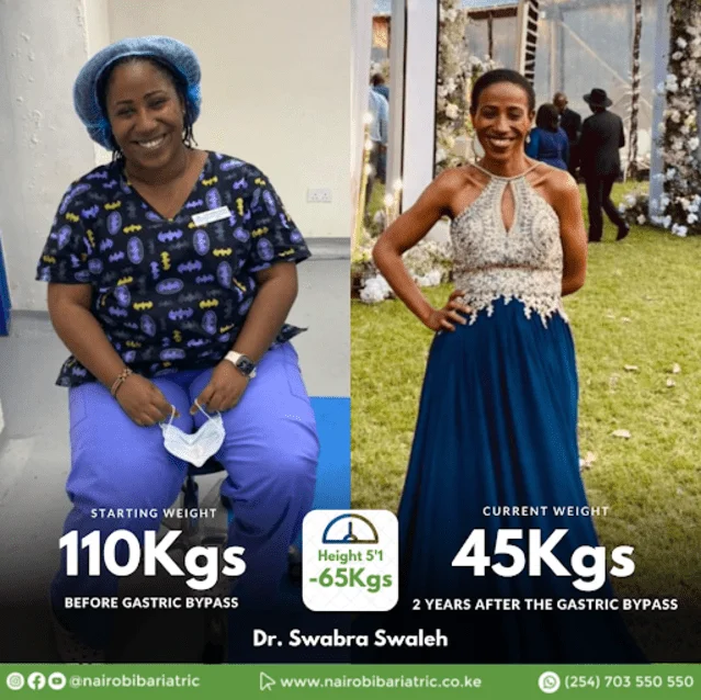 Dr. Swabra Swaleh 70 kg weight loss transformation result