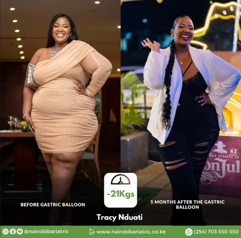 tracy_nduati_before_after_nairobi_bariatric