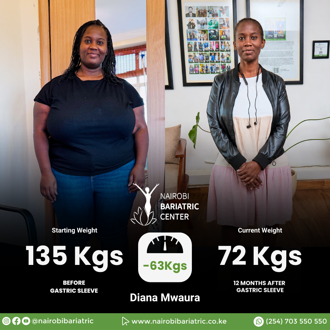 Diana Mwaura — Gastric Sleeve + PCEH