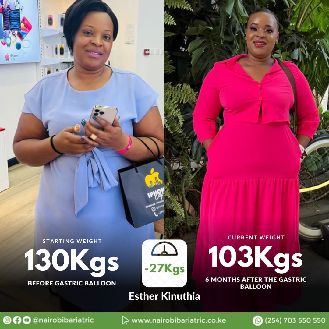 Esther Kinuthia — Gastric Balloon