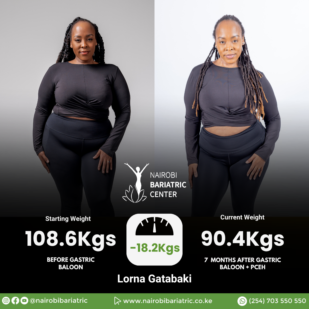Lorna Muchemi — Gastric Balloon