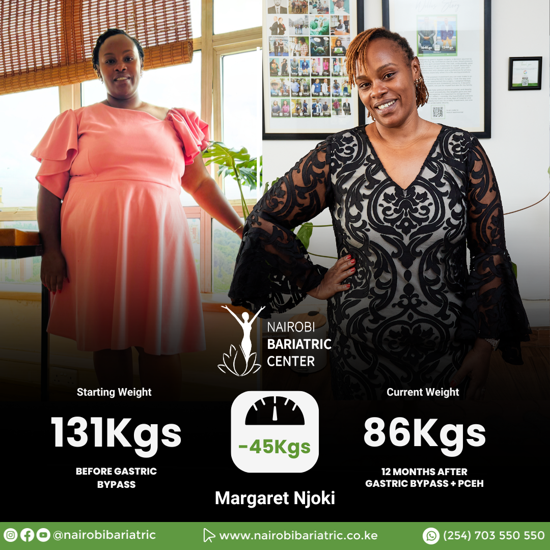 Margaret Njoki — Gastric Bypass