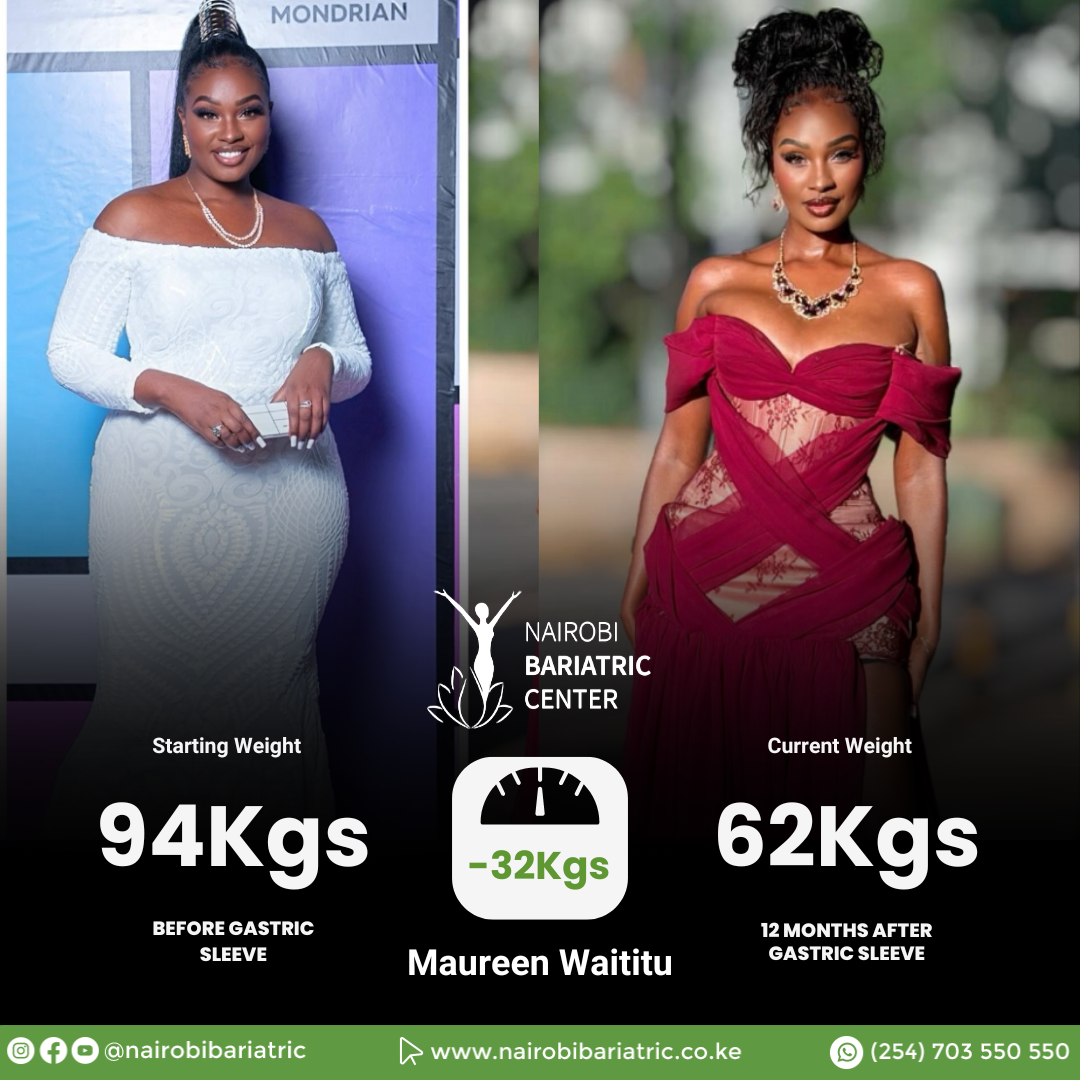 Maureen Waititu — Gastric Sleeve