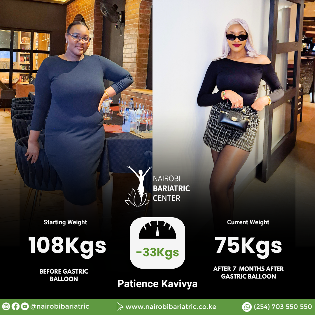 Patience Kavivya — Gastric Balloon + PCEH