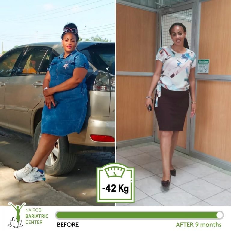 beforeafter2