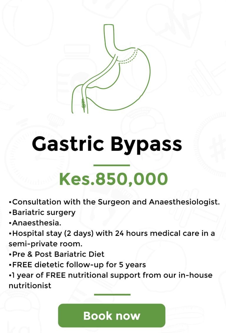 gastric bypass-min