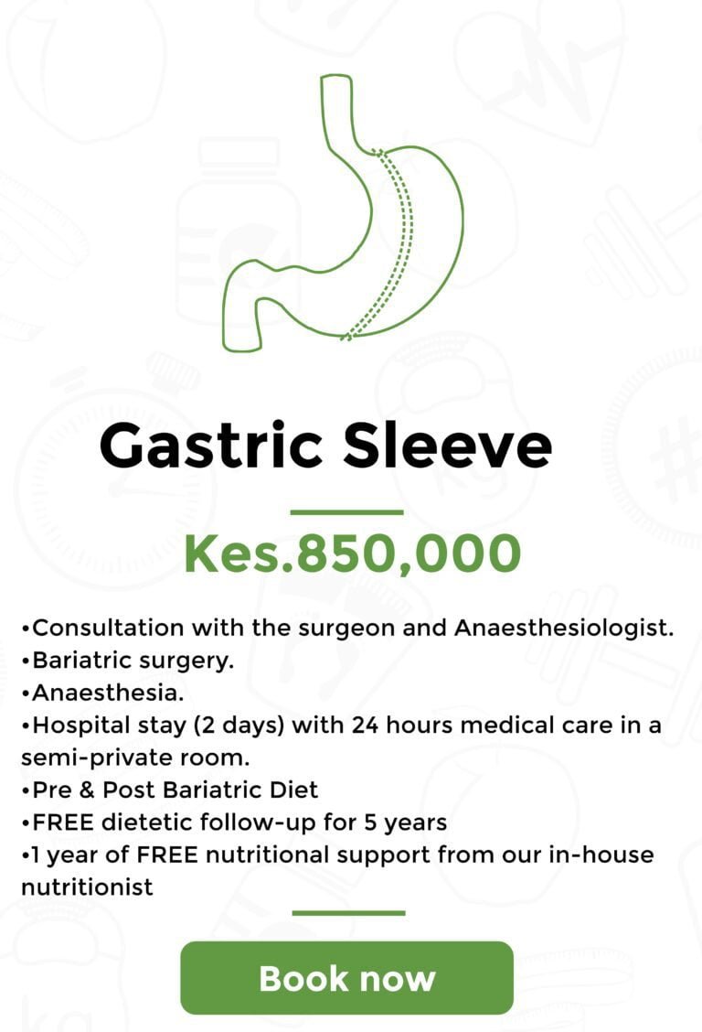 gastric sleeve-min