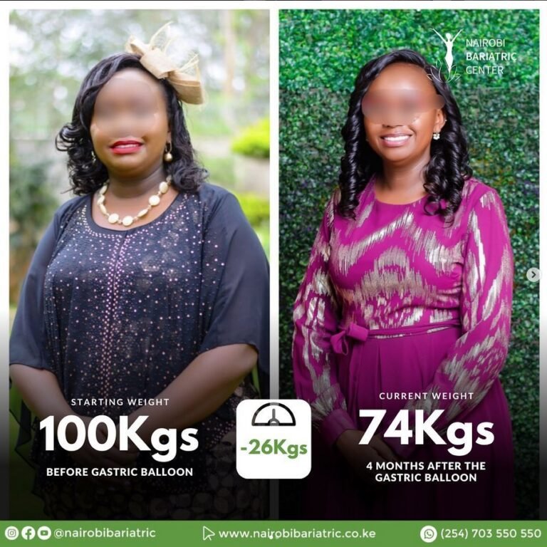 Nairobi Bariatric Center Patient testimonial